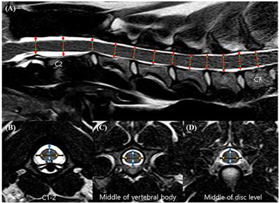 Morphometric Magnetic Resonance Imaging Evaluation of Cervical Spinal Canal and Cord in Normal Small-Breed Dogs